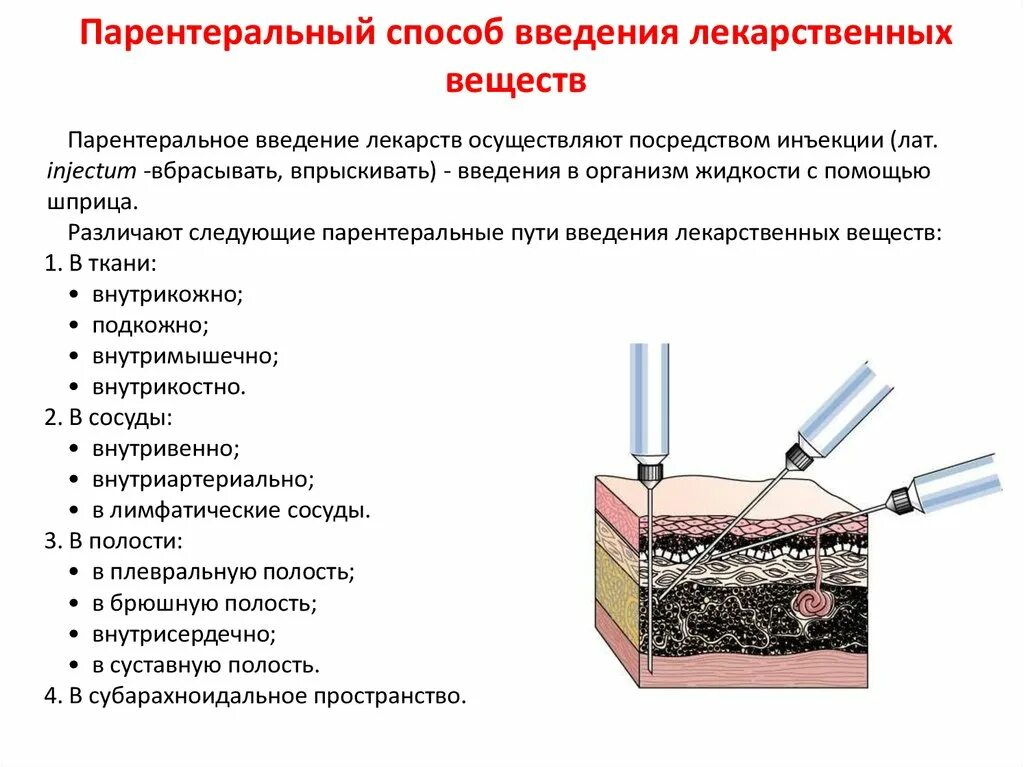 Назначение инъекций. Разновидность парентерального пути введения лекарственных средств. Парентеральный путь введения лекарств. Пути введения лекарственных средств парентеральный внутрикожно. Инъекционный способ введения лекарственных веществ.