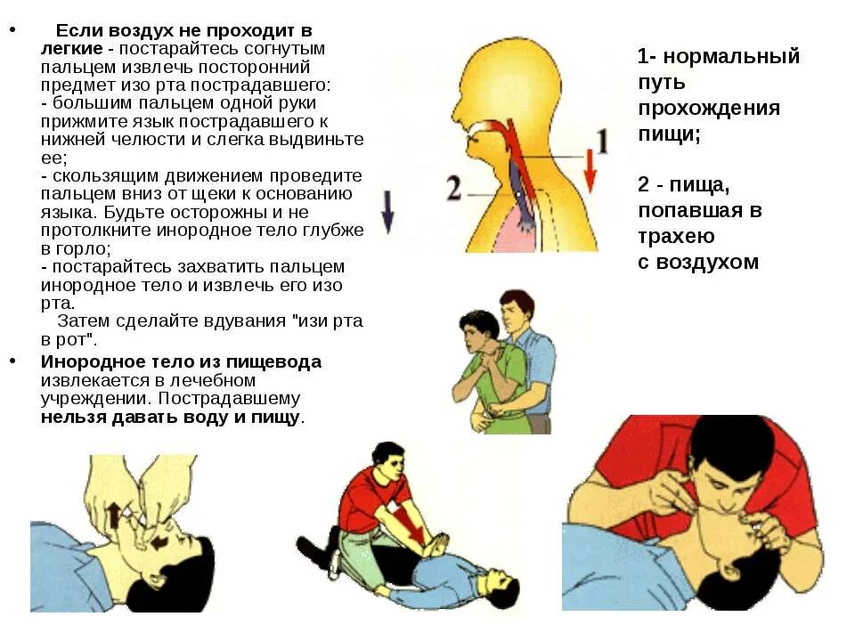 Первая помощь при попадании в глотку. Оказание первой помощи при дыхательной недостаточности. Неотложная помощь при обструкции дыхательных путей инородным телом. Оказание первой помощи при острой дыхательной недостаточности. Первая врачебная помощь при острой дыхательной недостаточности.