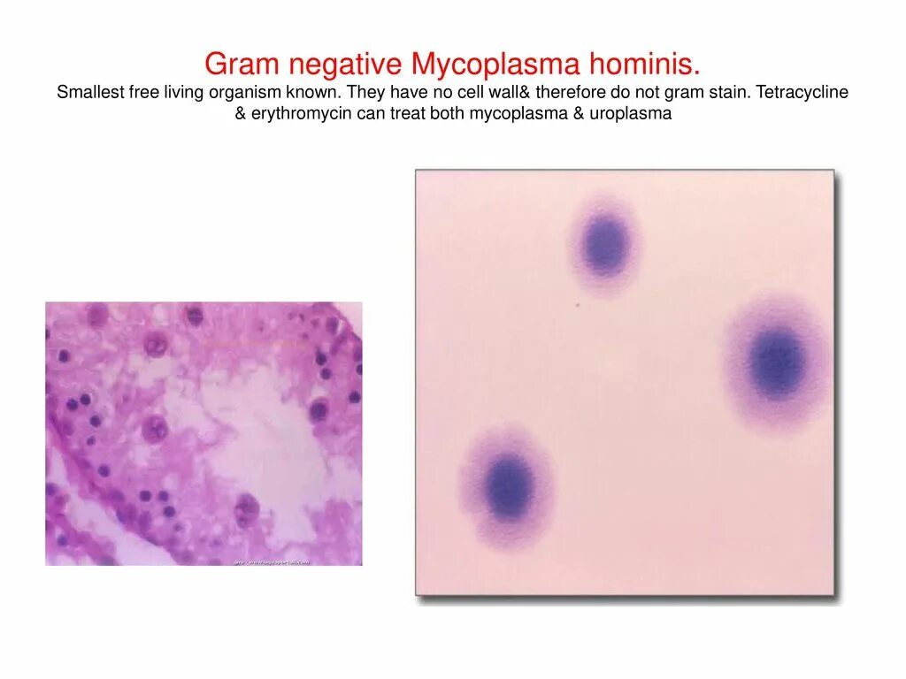 Mycoplasma hominis полукол днк. Микоплазма гоминис mycoplasma. гоминис микоплазма хоминис. cell wall mycoplasma.