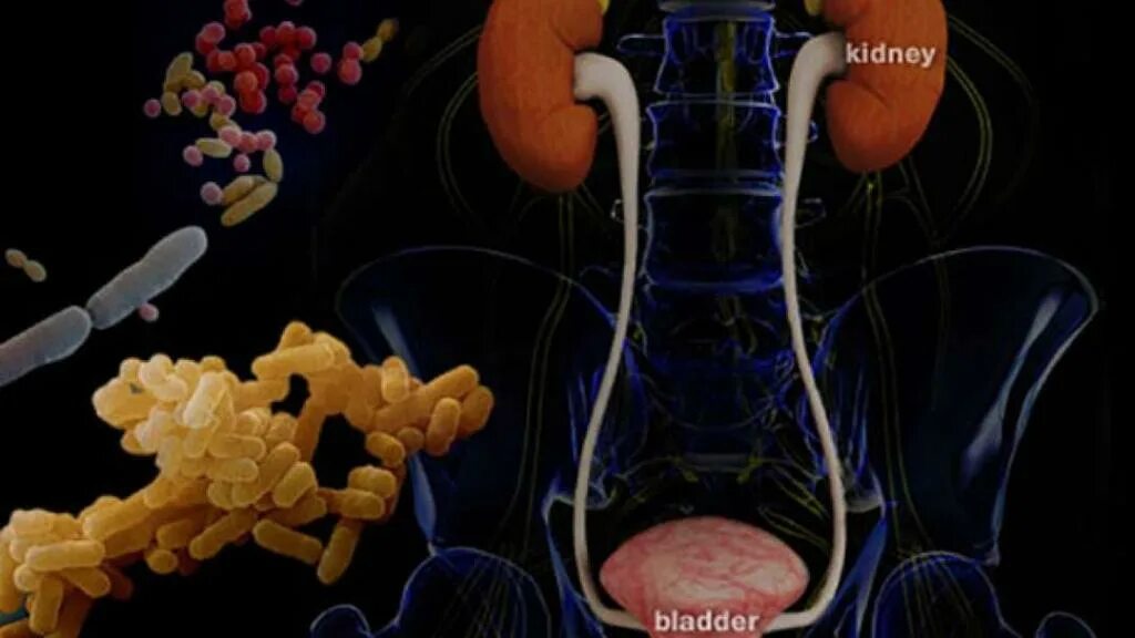 Инфекции мочевыделительной системы. Инфекционные заболевания мочевыделительной системы. Инфекция органов мочеполовой системы. Бактерии в мочевом пузыре.
