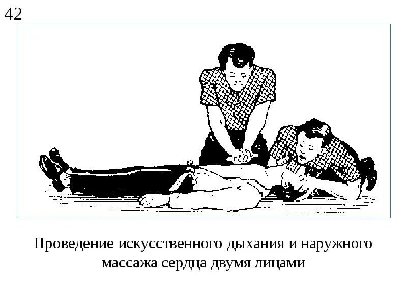 Основные виды неаппаратных способов искусственного дыхания. Способы искусственного дыхания. проведение наружного массажа сердца. схема искусственного дыхания.