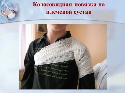 Колосовидная повязка на плечевой