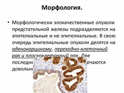 Отек предстательная железа