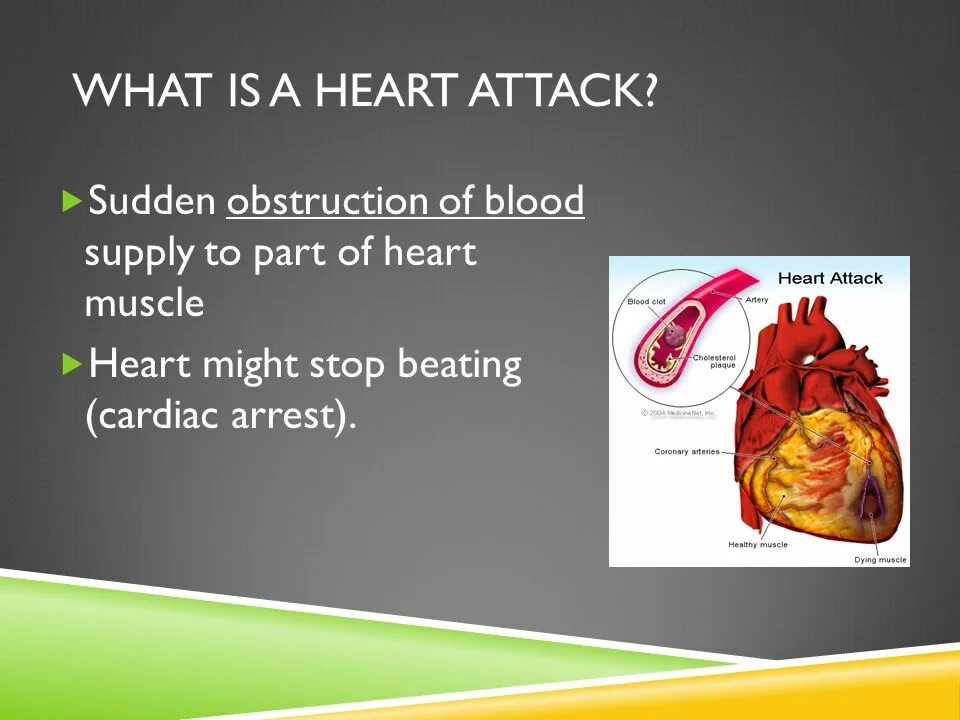 Heart attack speed up. Heart attack стенд. angina and heart attack. presentation attack.