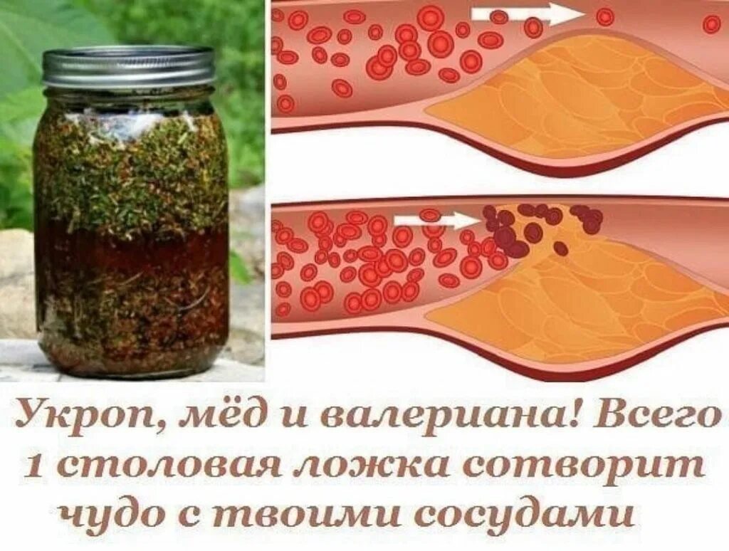 Как почистить сосуды вен