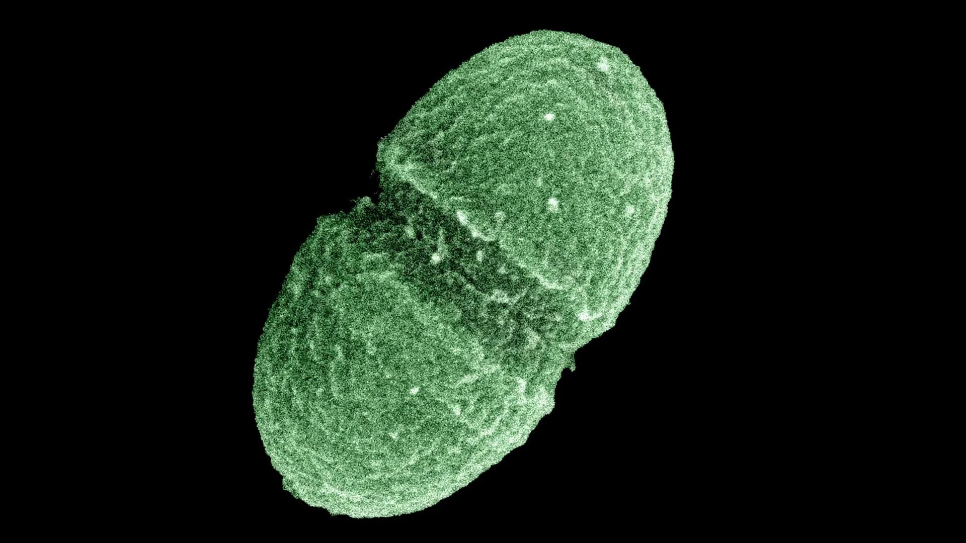 Olan bir. Энтерококк фациалис. Enterococcus faecium под микроскопом. Enterococcus faecalis под микроскопом. Энтерококки фото.