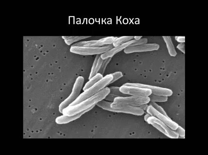 Туберкулезная бацилла