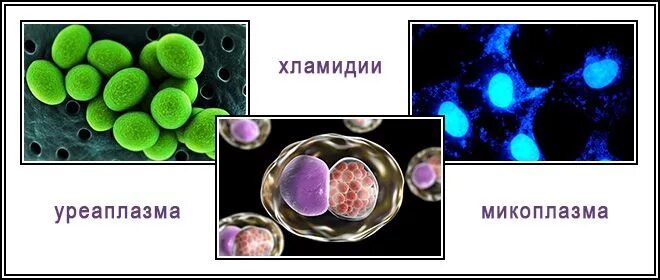 Хламидии микоплазма уреаплазма. Микоплазмоз, уреаплазмоз, хламидиоз.