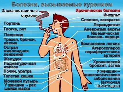 Что за заболевание могут быть