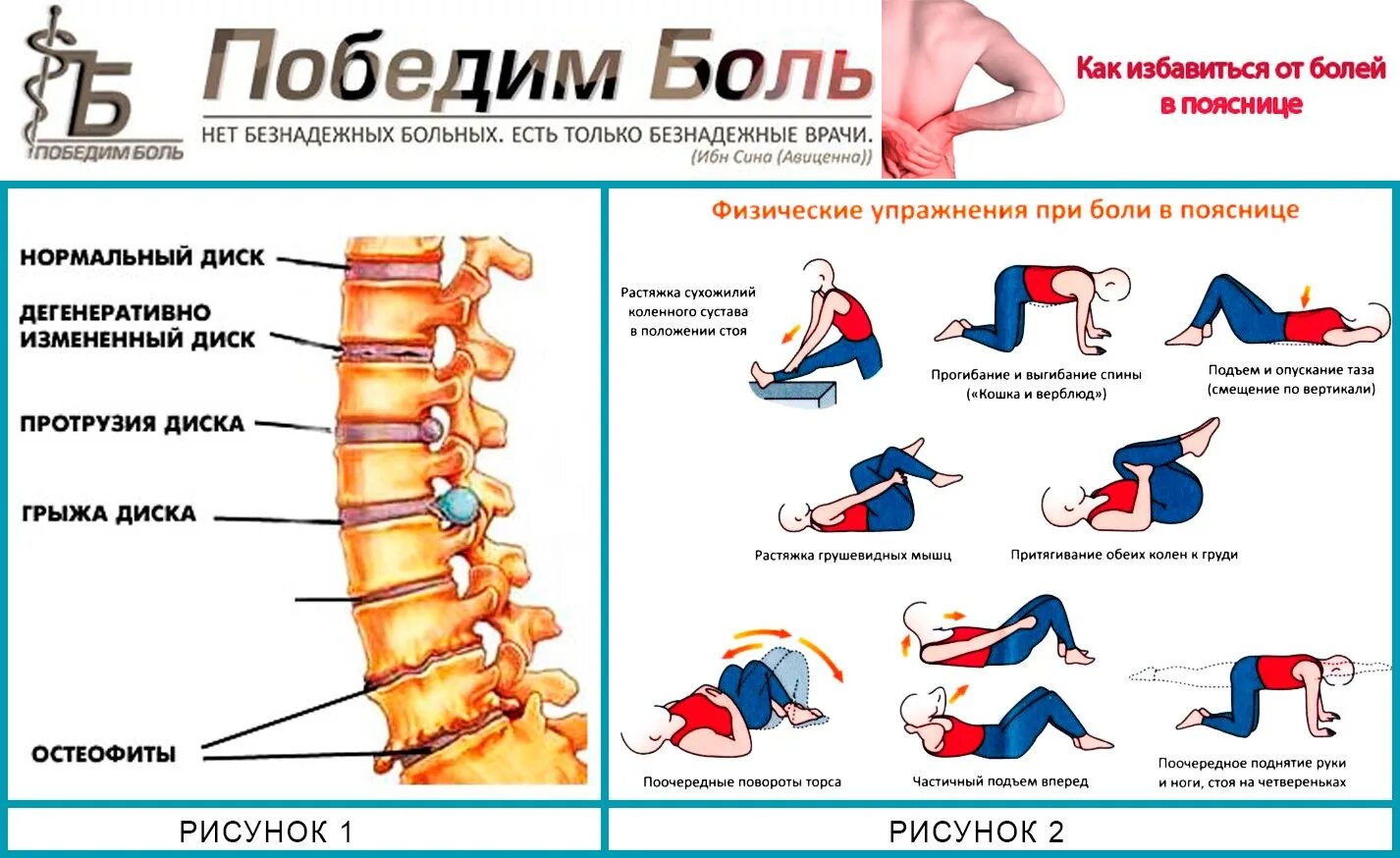 Что делать если болит поясница и ноги