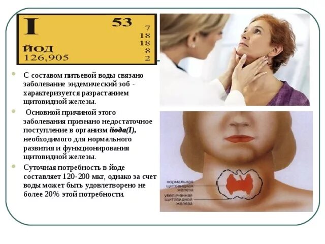 Пониженное содержание йода. Пониженное содержание йода в питьевой воде и пище приводит. пониженное содержание йода в питьевой воде. пониженное содержание йода в воде приводит к. пониженное содержание йода в питьевой воде приводит.