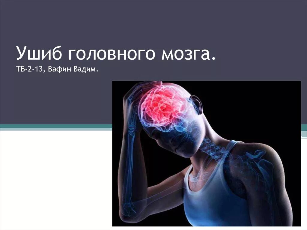 Закрытые повреждения мозга. Травмы головного мозга ушиб. Ушиб мозга легкой степени.