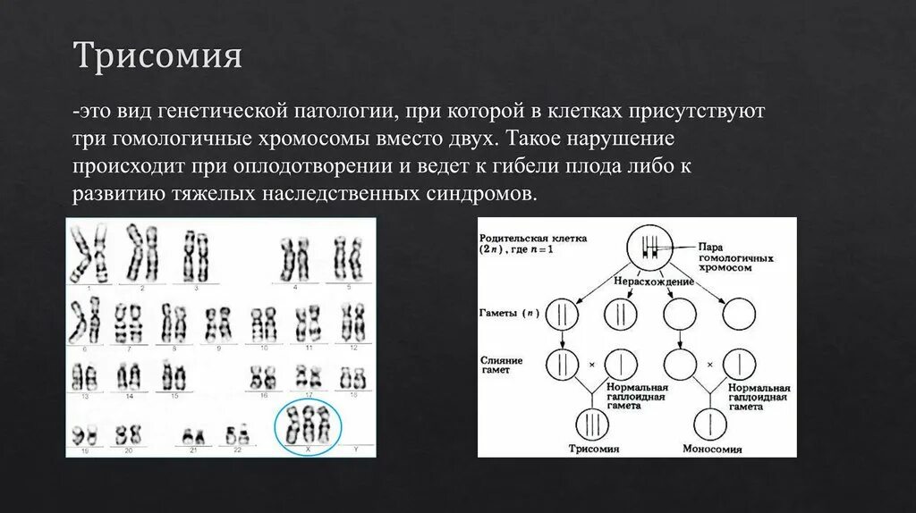 Синдром трисомия х механизм возникновения. Синдром трисомии х хромосомы.