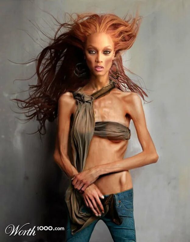 Как называют худых. Люди до и после анорексии. Худые модели. Бриджит малкольм анорексия. Луисель рамос.