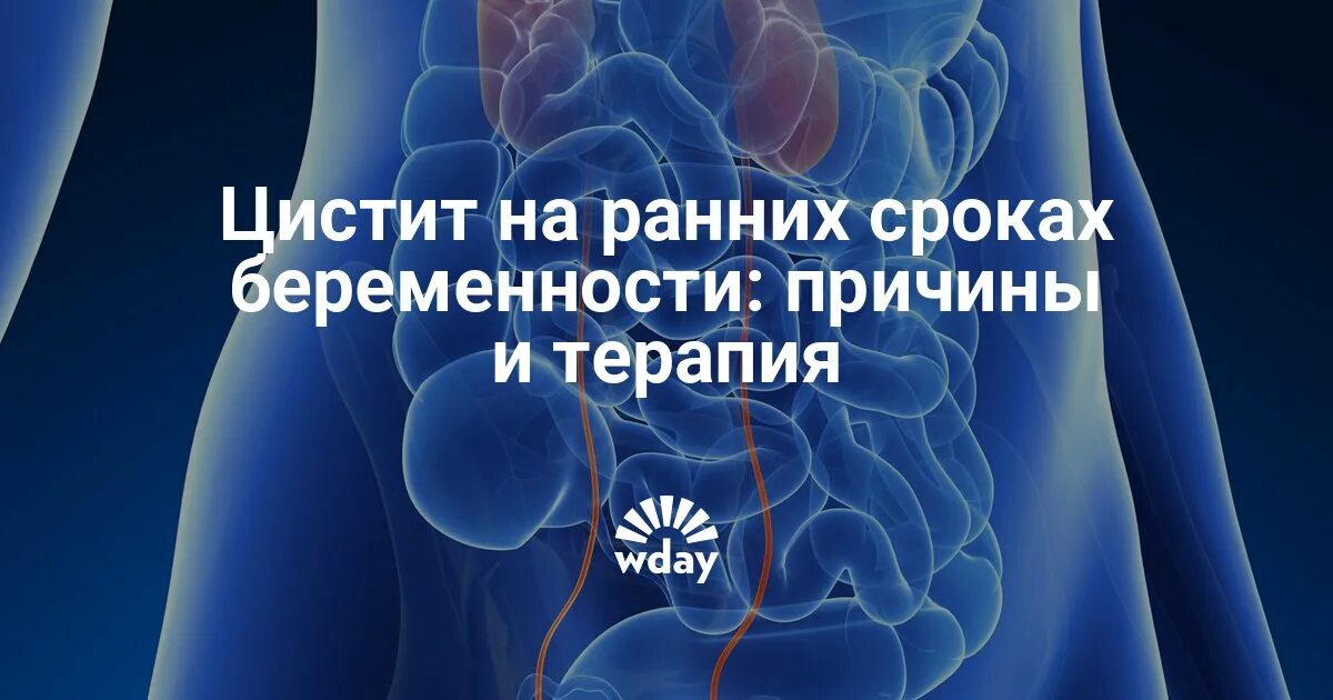 Цистит забеременеть. Цистит на ранних сроках. Цистит при беременности на ранних сроках. Цистит у женщин на ранних сроках беременности. Цистит при беременности на ранних сроках лечение.