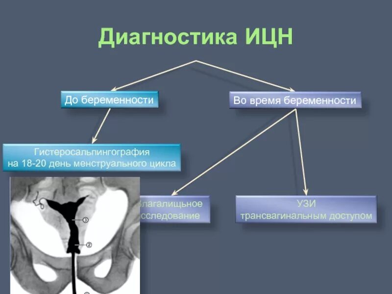 Ицн при беременности. Истмико-цервикальная недостаточность диагноз. Диагноз ИЦН. Истмико-цервикальная недостаточность критерии диагноза.