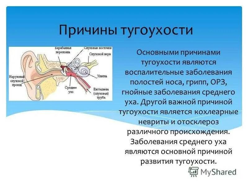 Слуховые пороги. Тугоухость ослабление слуховой функции. Причины нарушения слуха глухота. Причины потери слуха. Причины ухудшения слуха.