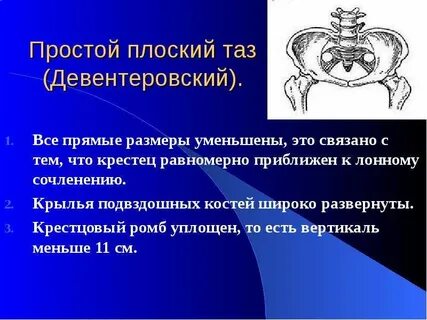 Плоский таз размеры