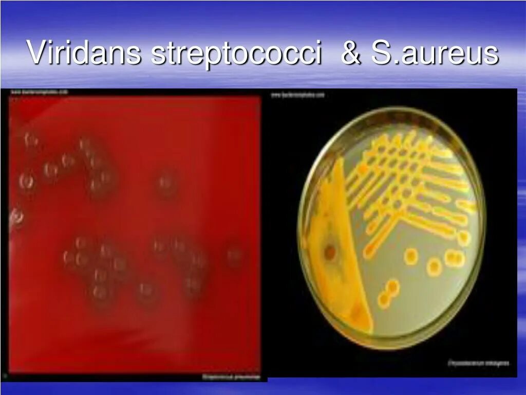 Aureus 10 4