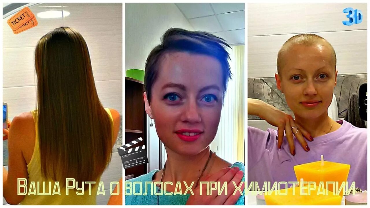 Волосы после химиотерапии. Отращивание волос. Отрастить волосы после химиотерапии. Отрастание волос после химиотерапии. Волосы после онкологии