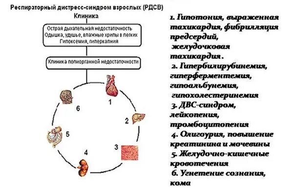 Респираторный дистресс взрослых. Острый респираторный дистресс-синдром жалобы. Острый респираторный дистресс-синдром симптомы. Стадии развития острого респираторного дистресс-синдрома. Острый респираторный дистресс-синдром клиника.