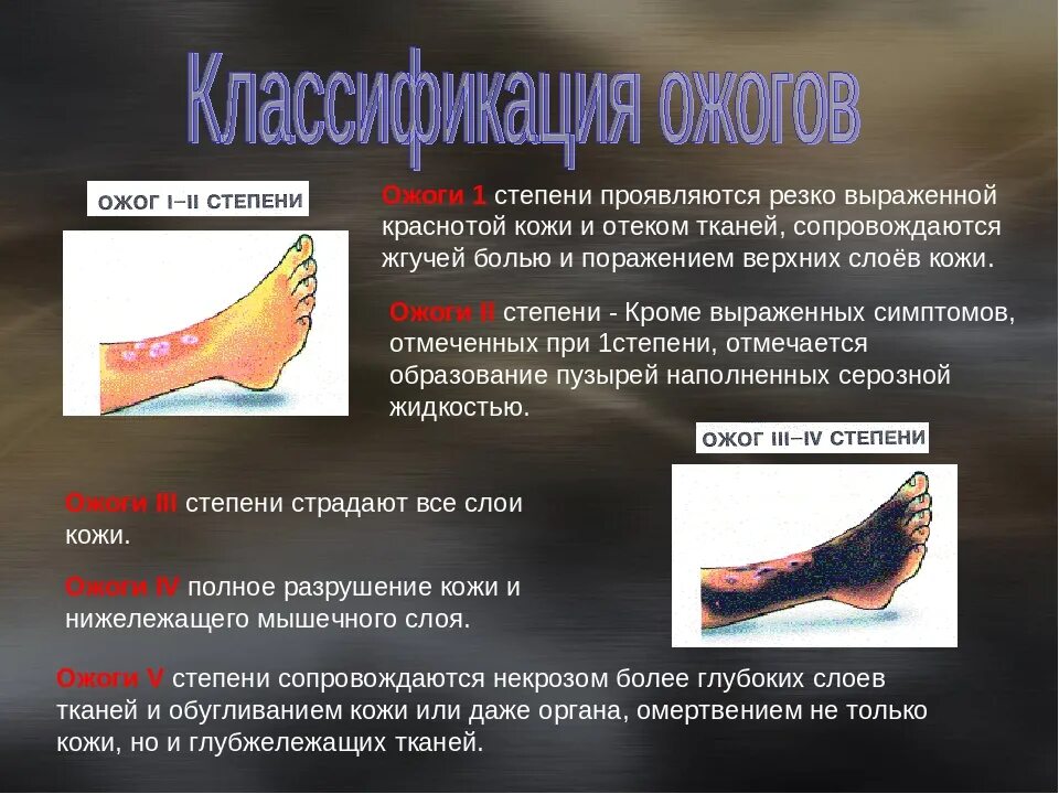 Какие степени термического