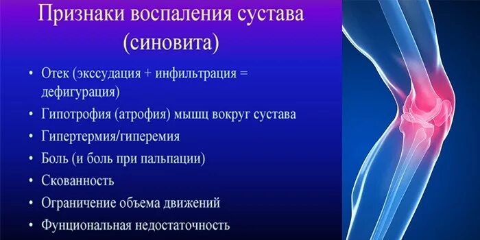 Симптомы синовита коленного сустава. Синовит коленного сустава рентген. Симптомы хронического синовита коленного сустава. Выпотной синовит коленного сустава.