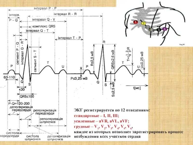 AVR AVL AVF отведения на ЭКГ норма. Грудные отведения ЭКГ норма. Отведение v1 на ЭКГ норма. Второе отведение v2 ЭКГ. Экг со скольки