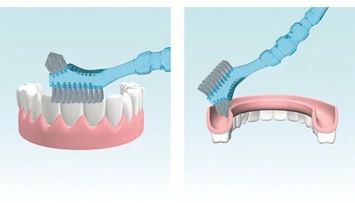 снимать ли протезы на ночь