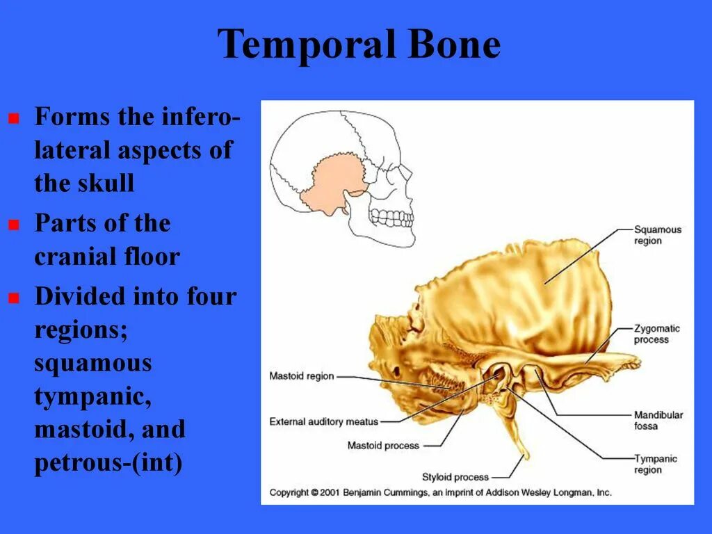 Височная кость. Височная кость анатомия. Темпорал бонез. Temporal Bone Anatomy. The bones form