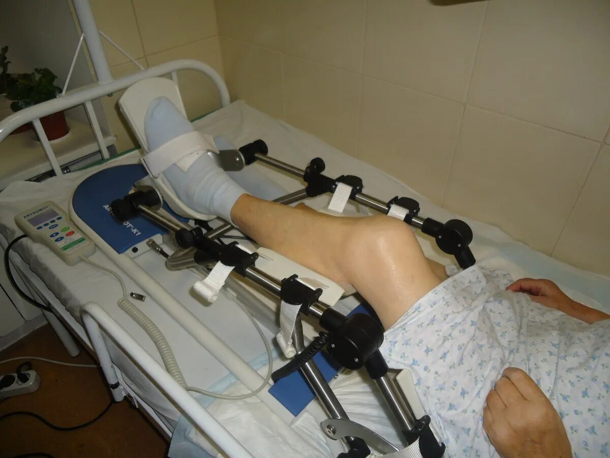 Магнитотерапия на коленный сустав после эндопротезирования. Эндопротезирование реабилитация. Аппарат для реабилитации коленного сустава после эндопротезирования. Магнитотерапия после эндопротезирования тазобедренного сустава. Реабилитация детей после операций