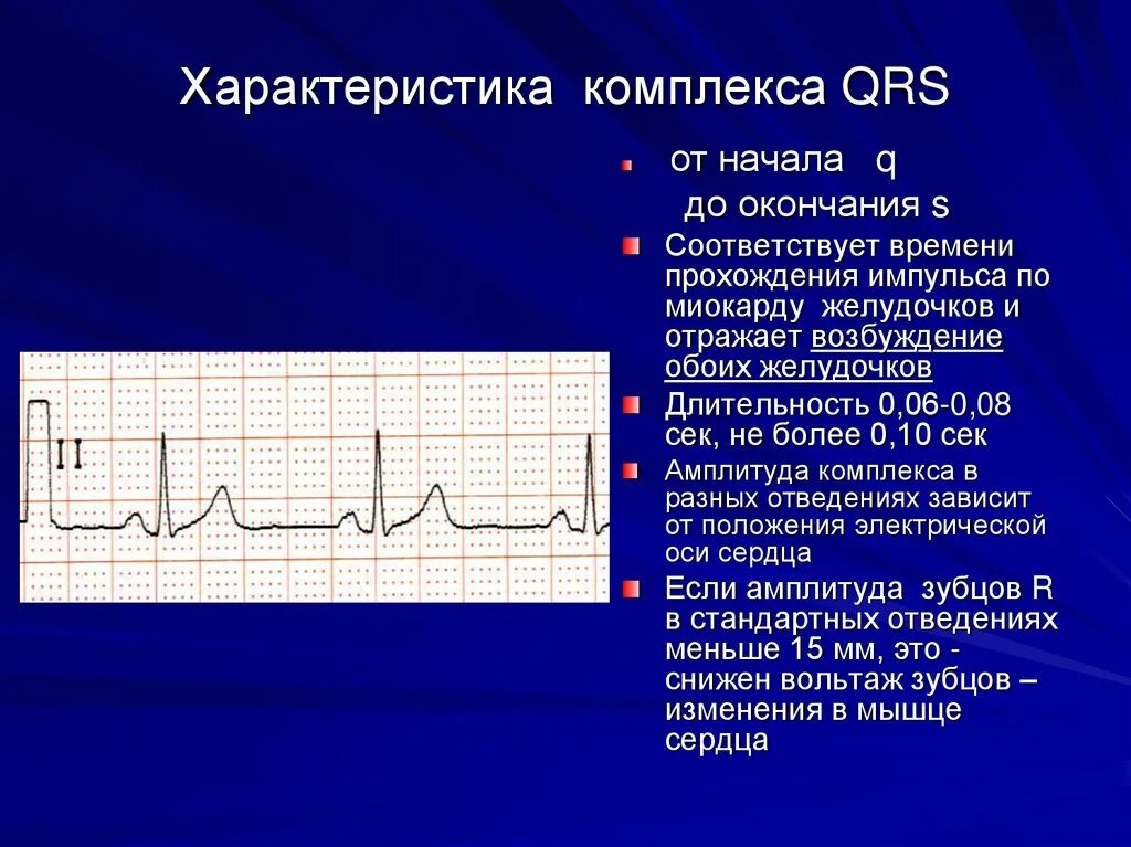 Изменение комплекса qrs. Комплекс qrs. отрицательный комплекс qrs. комплекс qrs амплитуда. параметры комплекса qrs.