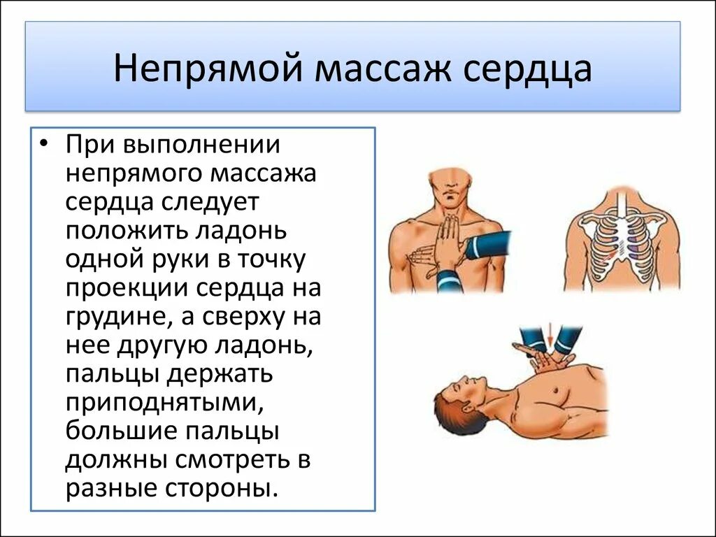 Как проводится непрямой массаж сердца. Положение рук реаниматора при проведении непрямого массажа сердца. Расположение ладони при проведении непрямого массажа сердца. Точка приложения рук при проведении непрямого массажа сердца. Точка давления на грудину при проведении непрямого массажа сердца.