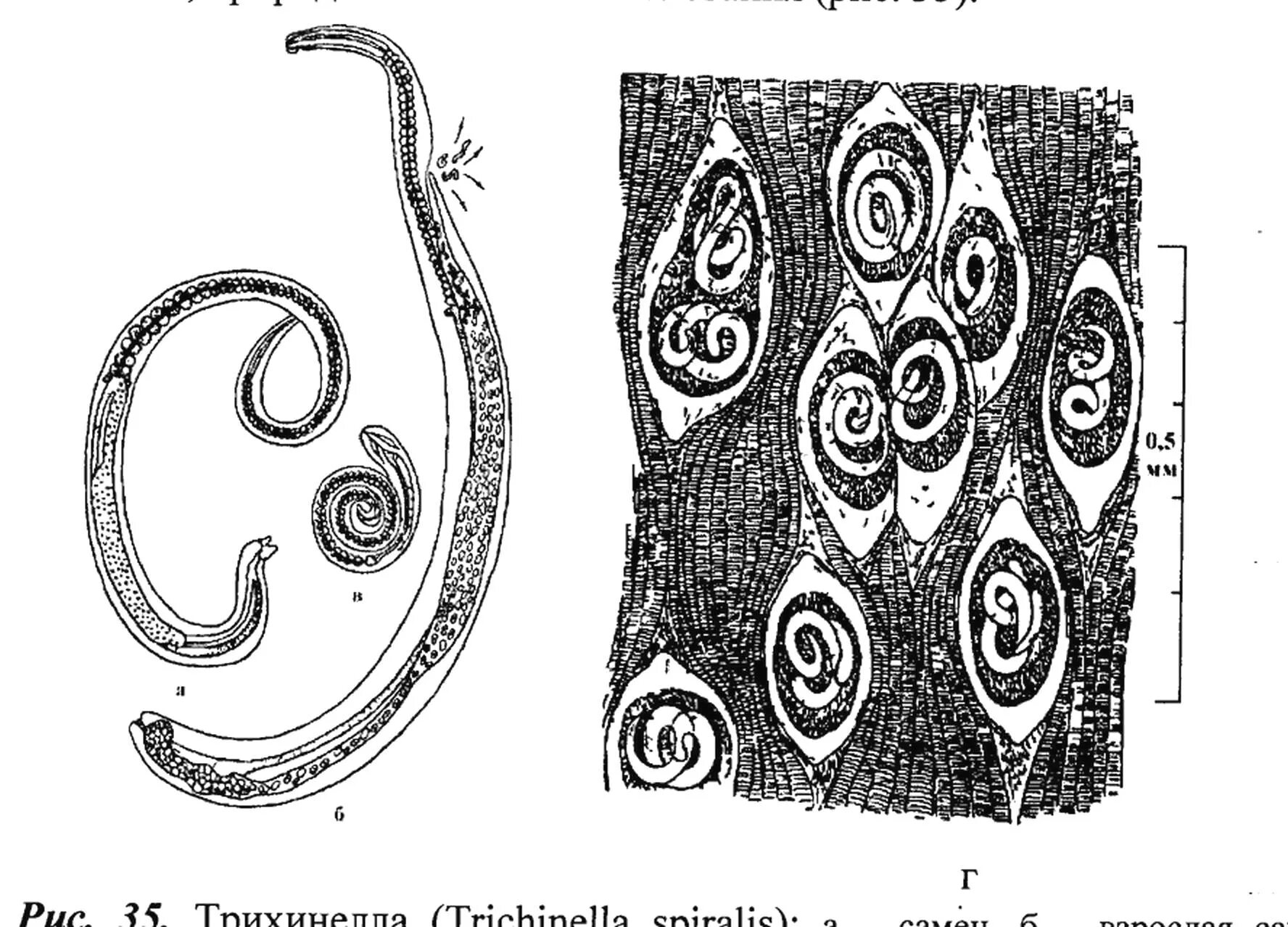 Трихинелла (Trichinella spiralis). Трихинелла самка и самец.