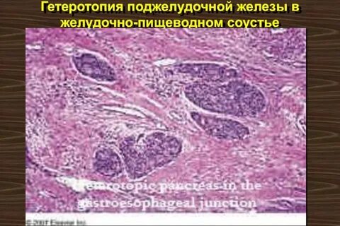 Ткани поджелудочной железы