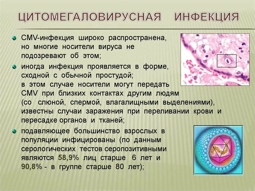 Цмв инфекция что это. Цитомегаловирусная инфекция (ЦМВИ). Цитомегаловирусная инфекция клинические симптомы. Цитомегаловирусная инфекция заражение. ЦМВ инфекция симптомы у женщин.