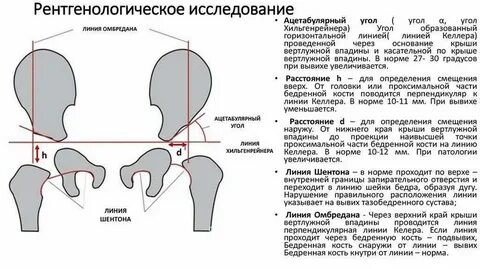 Седалищные бугры расстояние