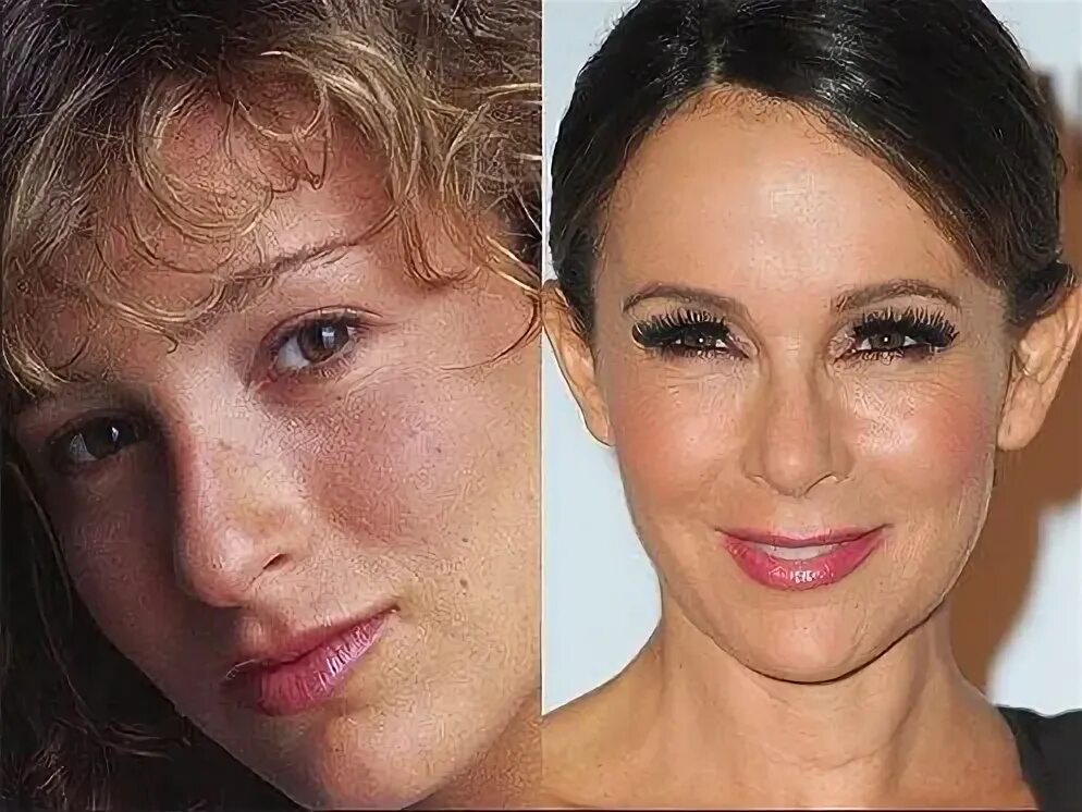 Неудачная пластика лица до и после Pourquoi alors qu'elle était si jolie vouloir ressembler à un canard Celebrity p