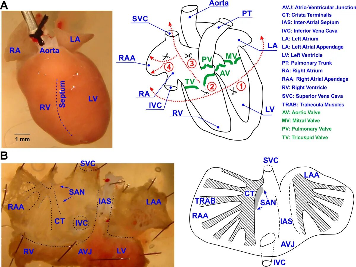 Map mouse. Left atrial dimension. disa optical map. node korea.