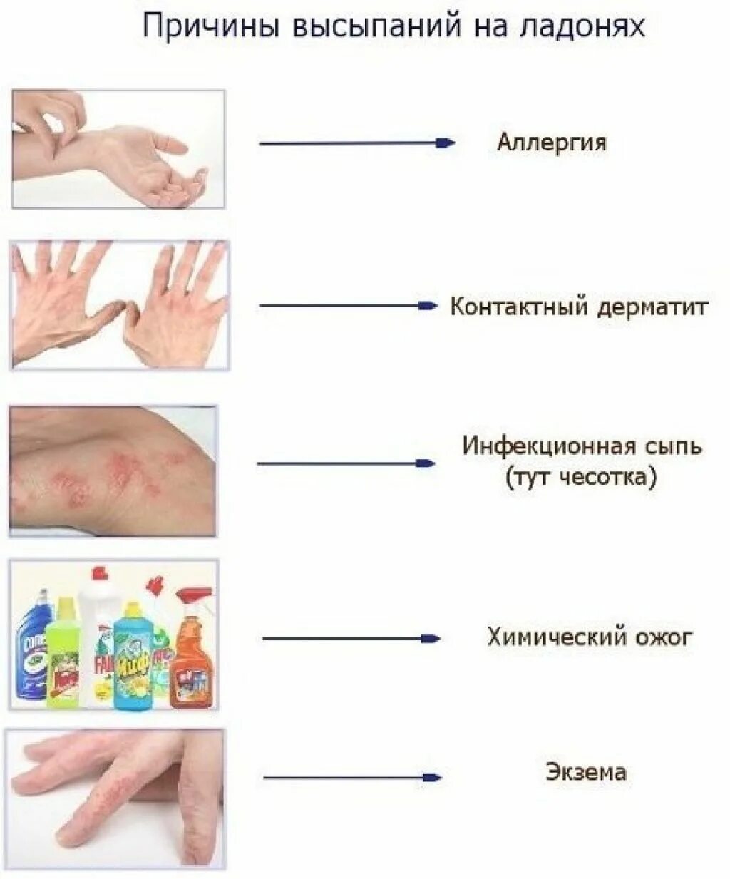 Почему температура пальцев