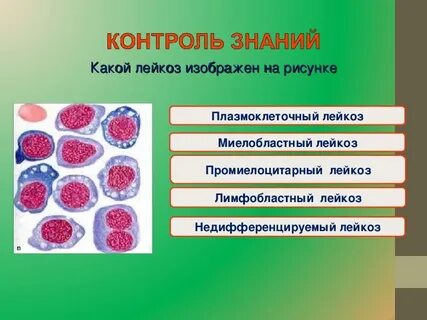 Острый плазмоклеточный лейкоз