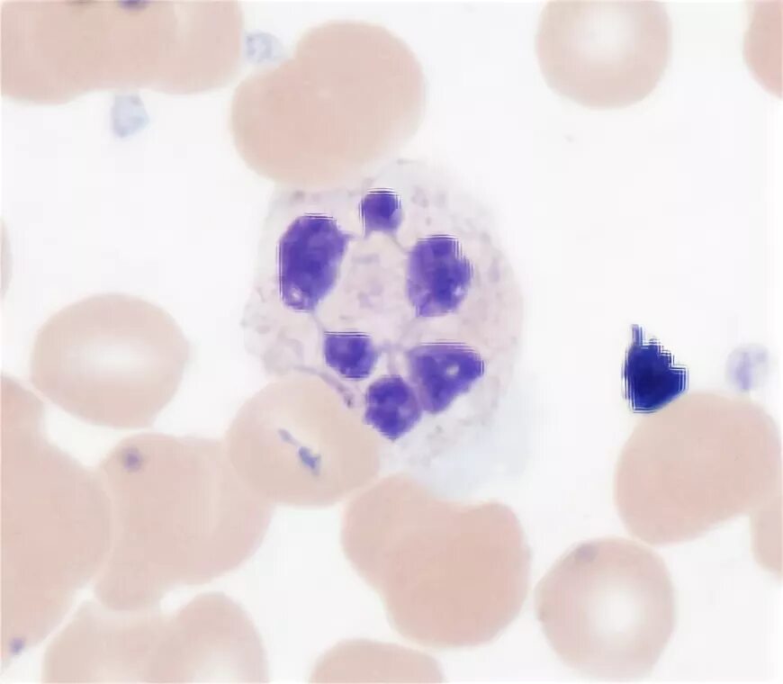 Палочкоядерный нейтрофил морфология. Сегментоядерный базофил. Палочкоядерный нейтрофил морфология. Лимфоцитарно-гранулоцитарный индекс. Сегментоядерные гранулоциты это.