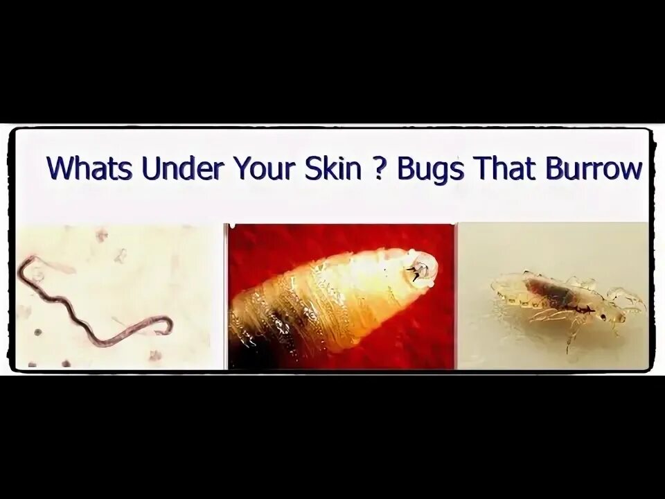 Bug skin. Bug skin