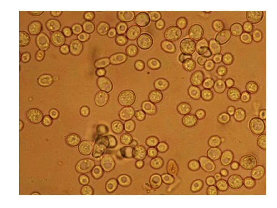 Дрожжевые клетки в моче повышены. Дрожжей Saccharomyces cerevisiae микроскопия. Saccharomyces cerevisiae микроскопия. Дрожжи Saccharomyces микроскопия. Клетку дрожжей Saccharomyces cerevisiae.