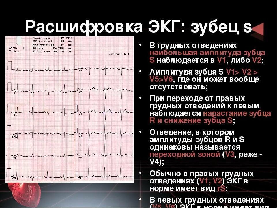 Кардиограмма сердца расшифровка норма у взрослых. Кардиограмма сердца расшифровка норма и патология. экг сердца qrs норма. v1-v3 на экг в норме. результаты экг норма у детей.