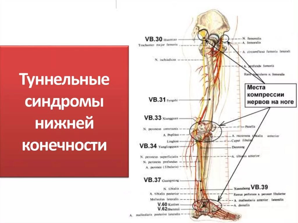 Области нижней конечности. Туннельный синдром малоберцового нерва. Туннельные синдромы нижних конечностей клинические рекомендации. Невропатия малоберцового нерва. Туннельный синдром малоберцового нерва симптомы.