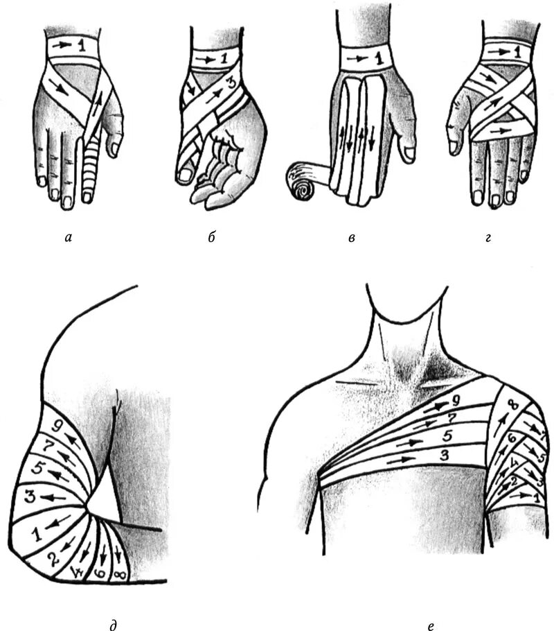 Повязка на руку схема. Черепашья бинтовая повязка. Повязки на верхнюю конечность десмургия. Перевязка колосовидная на предплечье. Десмургия перевязка руки.