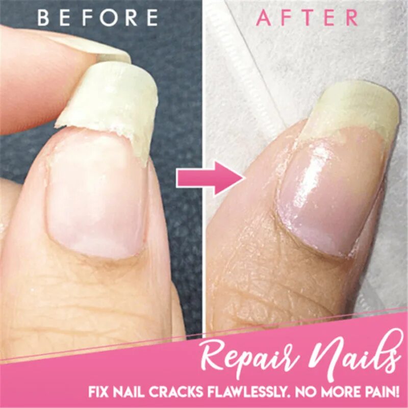 Трещина ногтя гель. Nail Repair для наращивания ногтей.