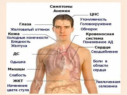 Симптомами анемии являются