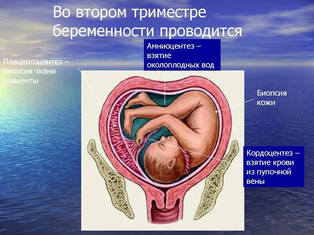 Ii триместр беременности. Триместры беременности. Взятие околоплодных вод.